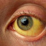 Hepatitis B - HBV Impfung