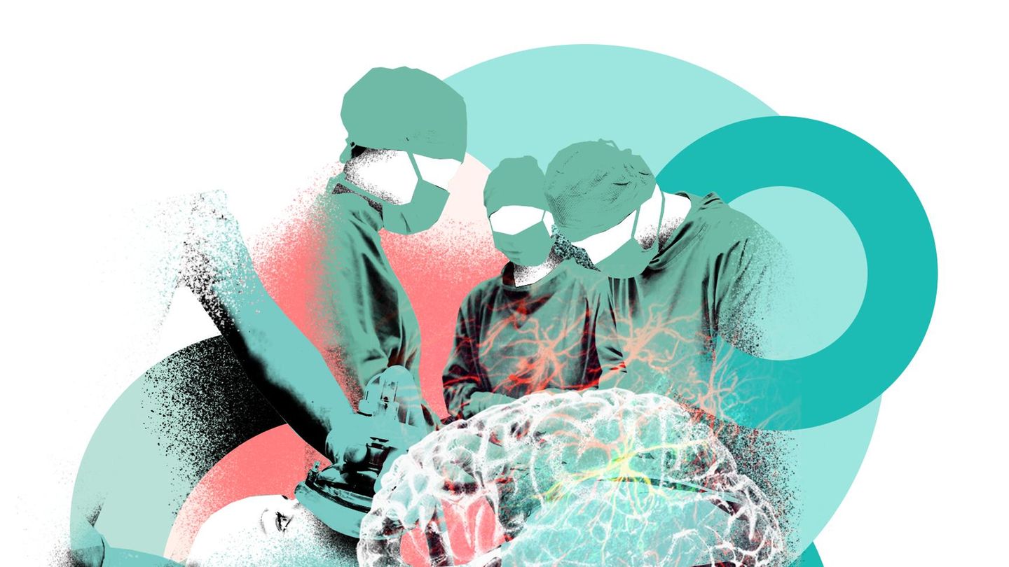 VOE STERN GESUND LEBEN 5/2022 Illustration Essay: Neurochirurgie; operieren im wachen Zustand. Illustration zu Neurochirurg Peter Vajkoczy