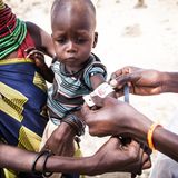 Mobiler Gesundheitscheck des lokalen Hospitals von Lokichar in der Region Tukana im Norden Kenias. Die Folgen der andauernden Dürre seit 2020 kann man am Armumfang der Kinder ablesen: Die dreijährige Mitchel ist untergewichtig und wächst nicht ihrem Alter entsprechend.