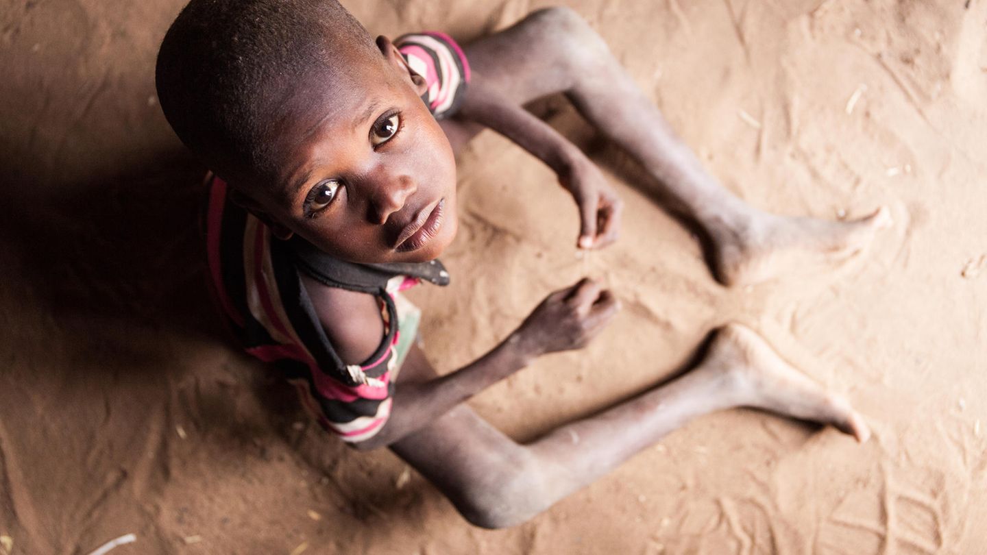 Dürre in Afrika: Der fünfjährige Junge Lomule Lokorimoe musste mit seinen Turkana-Eltern vor Viehdieben ins fliehen: Lomule ist abgemagert und zu klein für sein Alter. Folgen der Dürre, aber auch der steigenden Lebensmittelpreise durch Corona und den Krieg in der Ukraine. Die Preise für Grundnahrungsmittel haben sich mehr als verdoppelt. Der fünfjährige Junge Lomule Lokorimoe musste mit seinen Turkana-Eltern vor Viehdieben ins fliehen: Lomule ist abgemagert und zu klein für sein Alter. Folgen der Dürre, aber auch der steigenden Lebensmittelpreise durch Corona und den Krieg in der Ukraine. Die Preise für Grundnahrungsmittel haben sich mehr als verdoppelt.