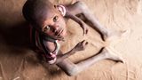 Der fünfjährige Junge Lomule Lokorimoe musste mit seinen Turkana-Eltern vor Viehdieben ins fliehen: Lomule ist abgemagert und zu klein für sein Alter. Folgen der Dürre, aber auch der steigenden Lebensmittelpreise durch Corona und den Krieg in der Ukraine. Die Preise für Grundnahrungsmittel haben sich mehr als verdoppelt.