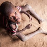 Der fünfjährige Junge Lomule Lokorimoe musste mit seinen Turkana-Eltern vor Viehdieben ins fliehen: Lomule ist abgemagert und zu klein für sein Alter. Folgen der Dürre, aber auch der steigenden Lebensmittelpreise durch Corona und den Krieg in der Ukraine. Die Preise für Grundnahrungsmittel haben sich mehr als verdoppelt.