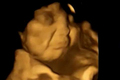 Studie: Kinder hassen grünes Gemüse schon im Bauch der Mutter