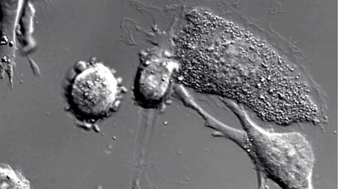 Spektakuläre Mikro-Welten: So sieht es aus, wenn Krebszellen sterben