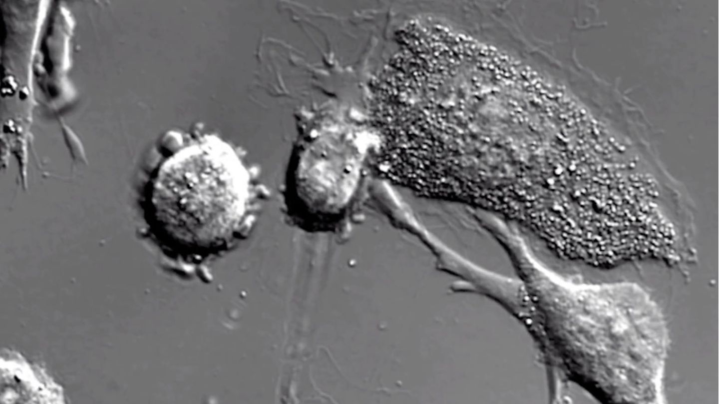 Niesamowite mikroświaty: tak to jest, gdy umierają komórki rakowe