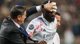Rüdiger zieht sich eine "ziemlich lange" Platzwunde am Auge zu, wie es Real-Trainer Carlo Ancelotti nach dem Spiel ausdrückt. Er wird von einem Betreuer vom Platz geführt.