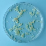 Gewebe, vierte Schwangerschaftswoche