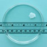 Sechste Schwangerschaftswoche