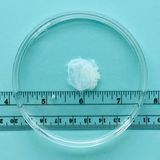 Schwangerschaftsgewebe, siebte Woche