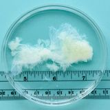 Neunte Schwangerschaftswoche