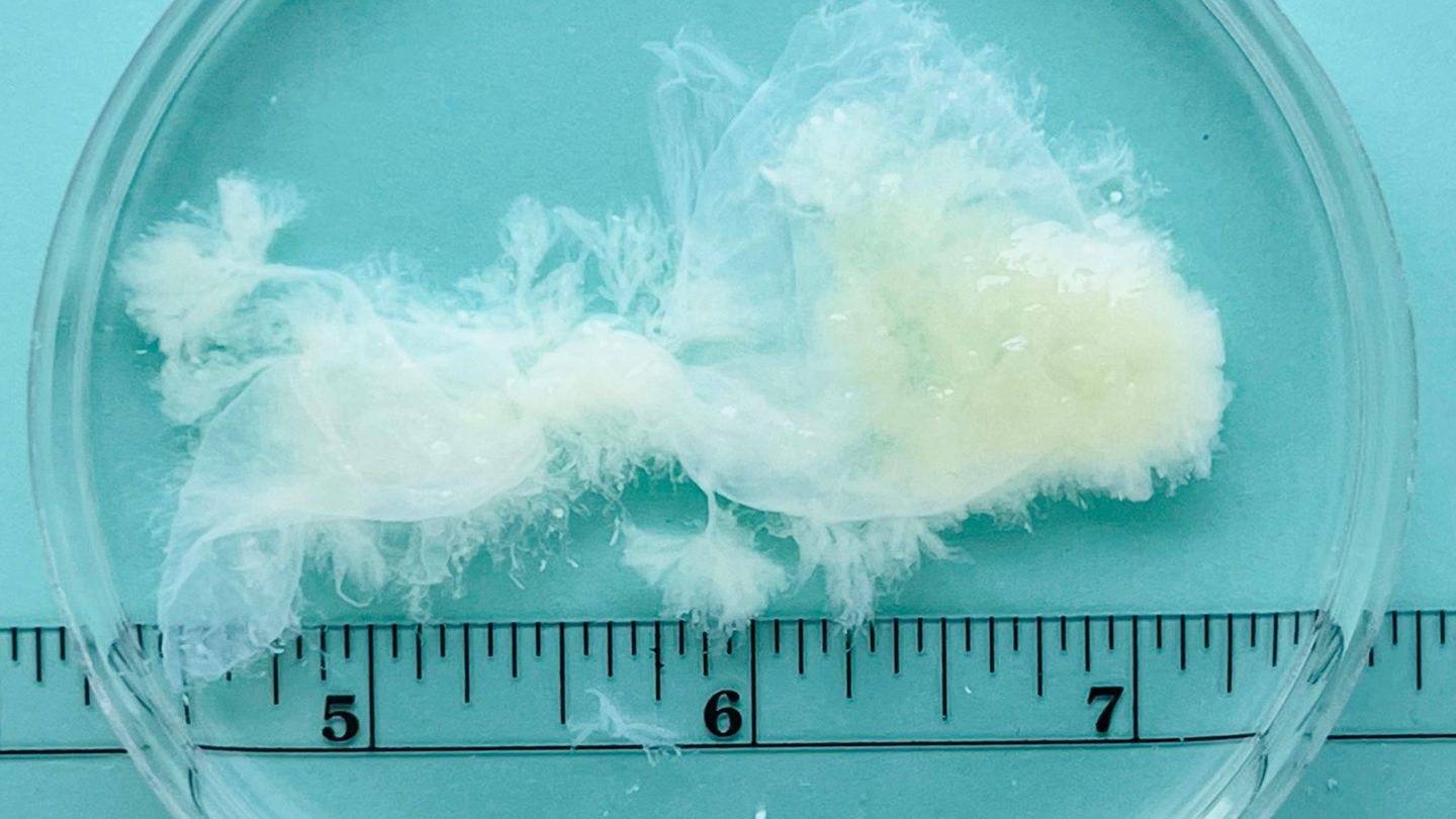 Neunte Schwangerschaftswoche