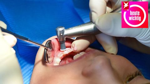 Ein junge liegt mit offenem Mund auf einem Zahnarztstuhl, während Hände in Gummihandschuhen Bohrer und Spiegel halten