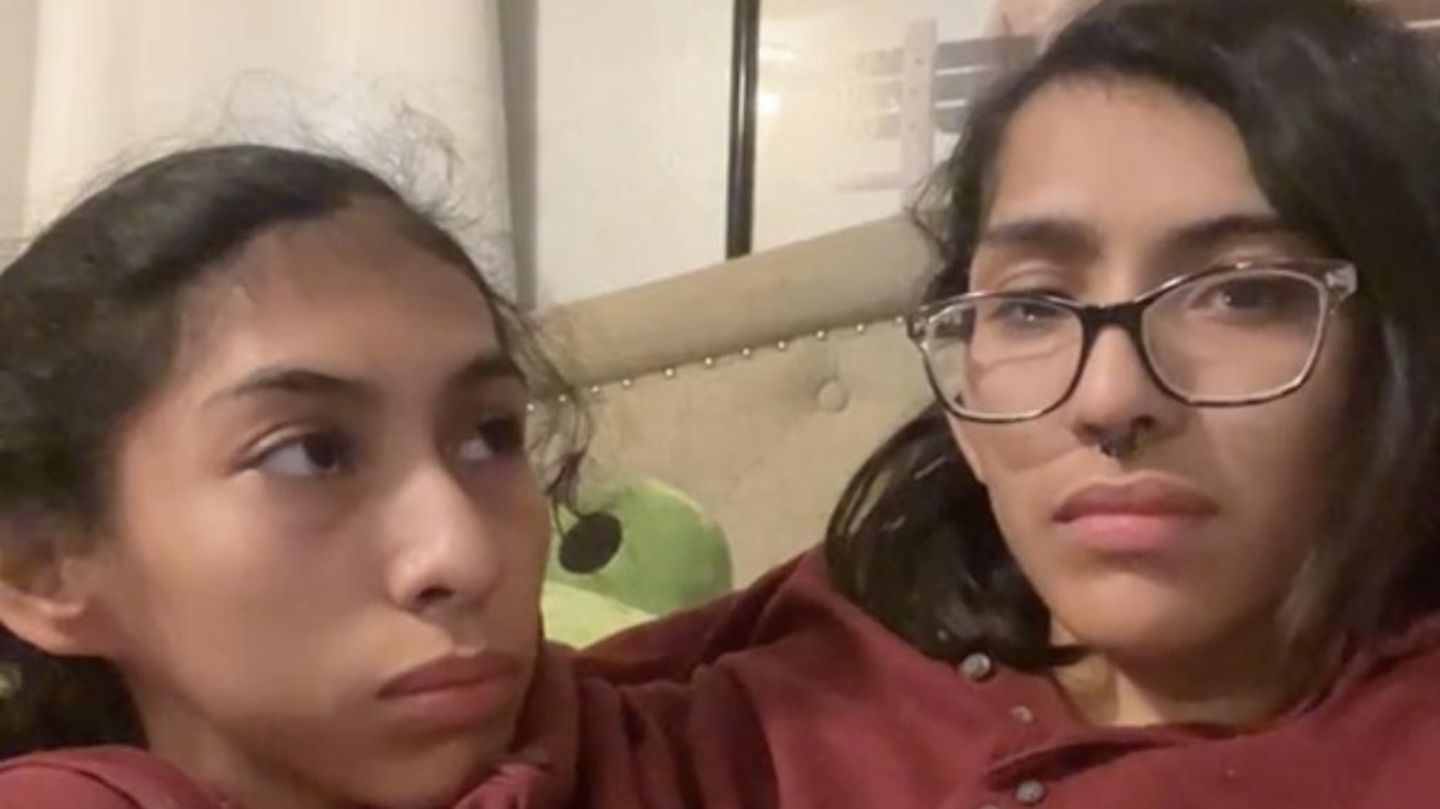 Siamesische Zwillinge Carmen und Lupita Andrade