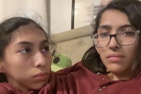 Siamesische Zwillinge Carmen und Lupita Andrade