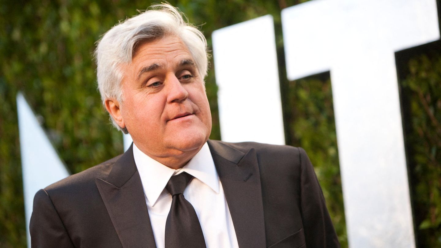 Jay Leno suffers severe burns to his face