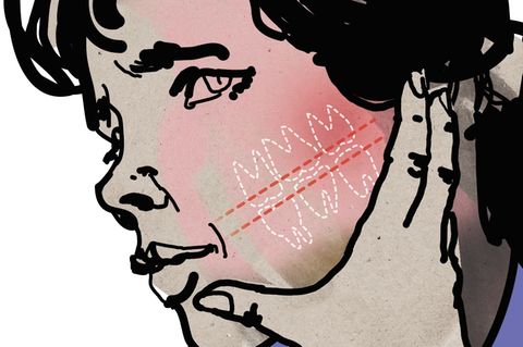 Illustration zu Zahnschmerzen