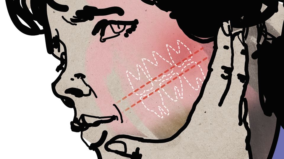 Illustration zu Zahnschmerzen