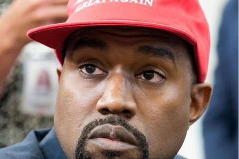 Tattoos von Kanye West kann man in London kostenlos entfernen lassen