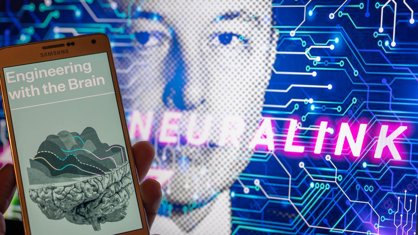 Ein Smartphone zeigt ein Bild eines Gehirns mit Elon Musk im Hintergrund