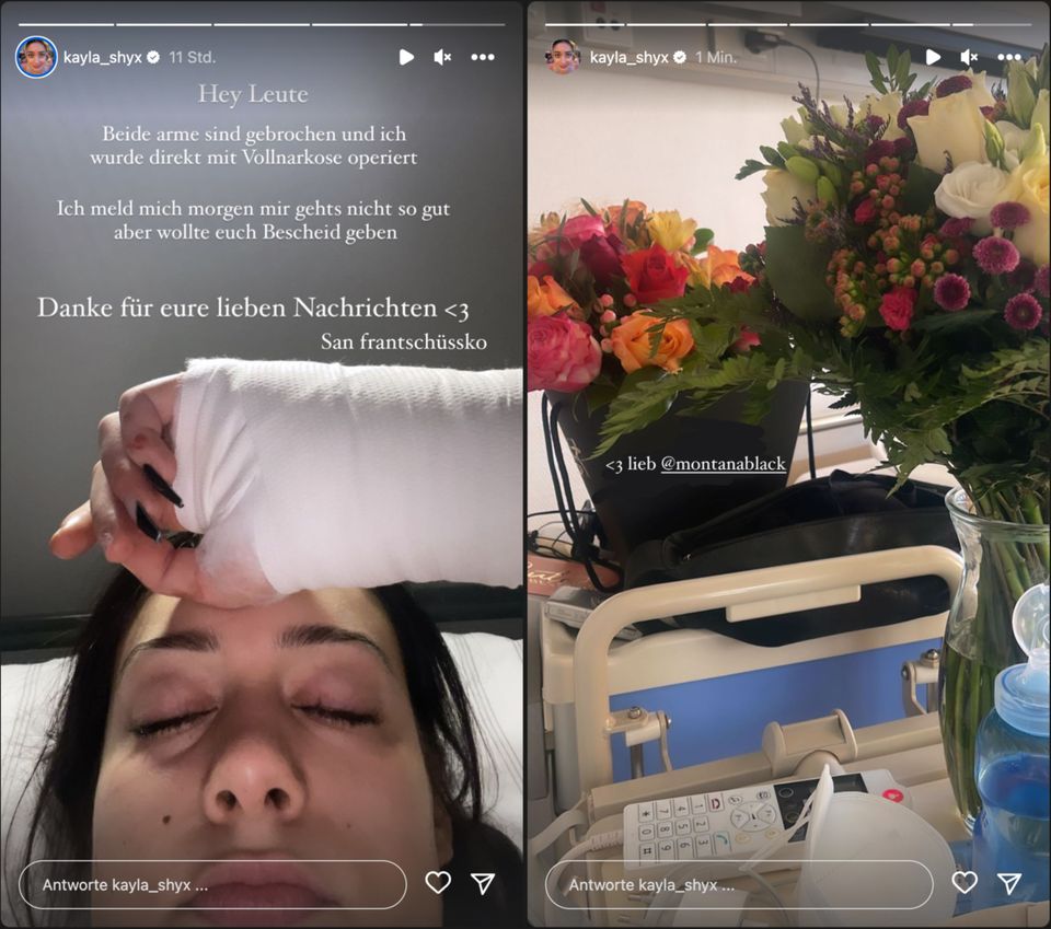 Stories aus der Nacht und vom Nachmittag: Kayla Shyx musste mit Armbrüchen operiert werden.