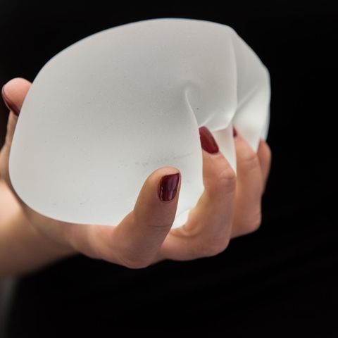 Eine Frau mit einem Brustimplantat. Krankheiten nach der OP sollen nun besser erforscht werden.