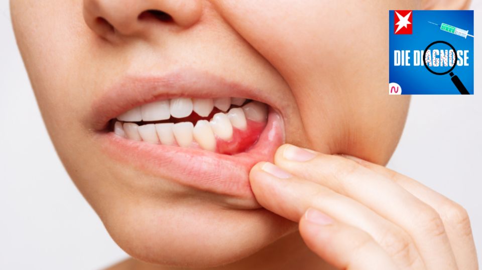 Eine Frau geht mit stark entzündeten Zahnfleisch zum Zahnarzt