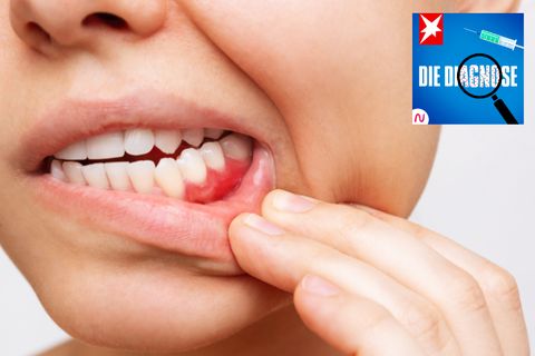 Eine Frau geht mit stark entzündeten Zahnfleisch zum Zahnarzt