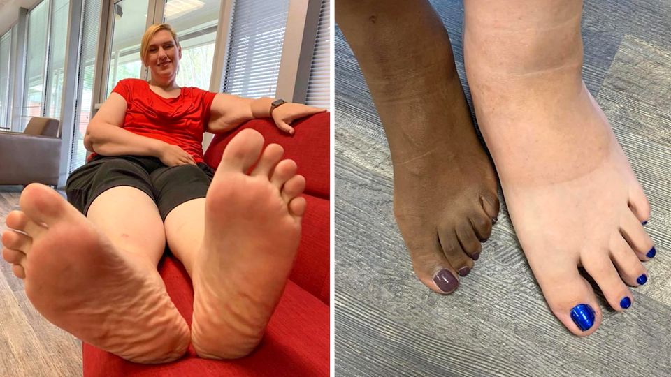 Größe 51: Diese US-Amerikanerin hat die größten Frauen-Füße der Welt Größe 51: Diese US-Amerikanerin hat die größten Frauen-Füße der Welt