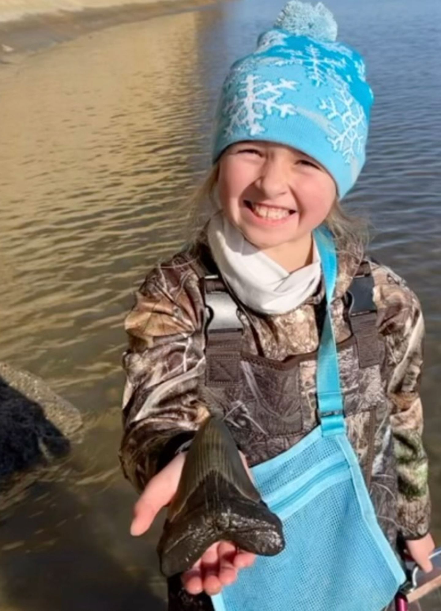 Die neunjährige Molly mit einem Haifischzahn