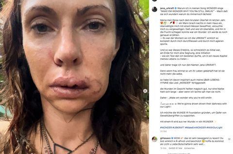 Dschungelcamp-Teilnehmerin: Versuchte Vergewaltigung: Warum Jana Pallaske dieses Foto ausgerechnet jetzt postet