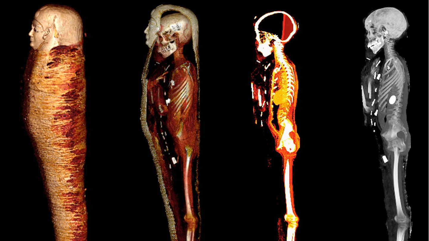 Vier Bilder einer Mumie zu sehen: links das Äußere, rechts das Skelett, in der Mitte zwei Zwischenstufen vor schwarzem Grund