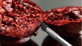 Endometriose: Die Fotografin Jasmin Breidenbach zeigt, wie sich Endometriose für Betroffene wirklich anfühlt