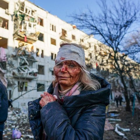 Der erste Tag des Krieges in der Ukraine: Das Bild der verletzten Olena Kurylo ging um die Welt