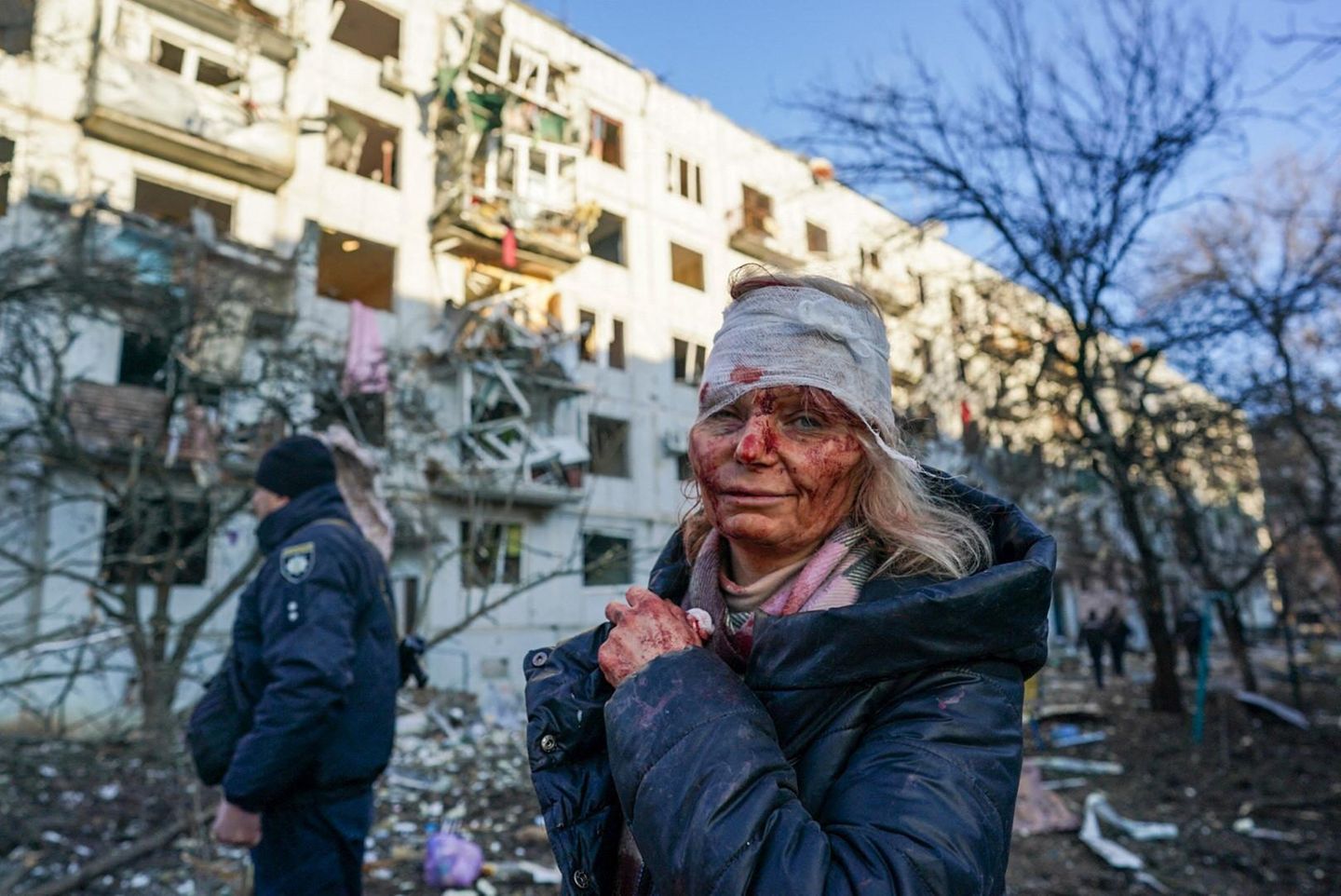 Der erste Tag des Krieges in der Ukraine: Das Bild der verletzten Olena Kurylo ging um die Welt
