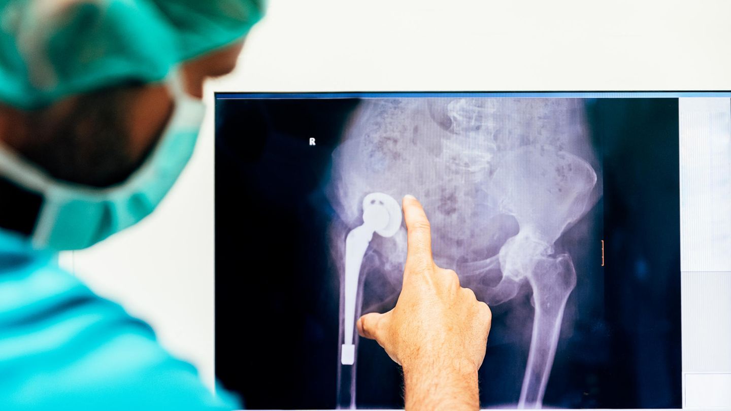 Arzt schaut sich Röntgenbild an