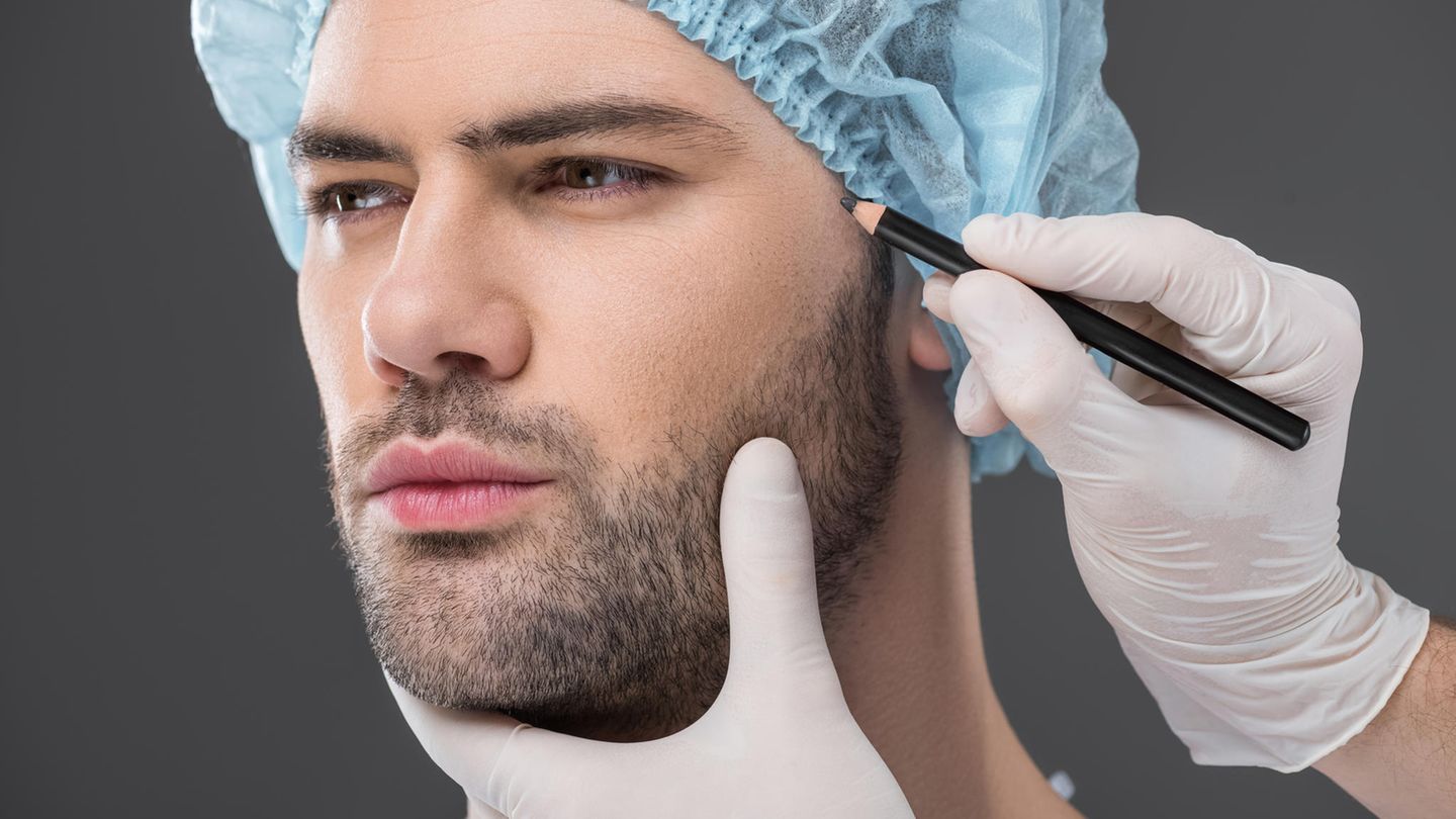 Facelifting: Das sind empfehlenswerte Ärzte aus dem Bereich