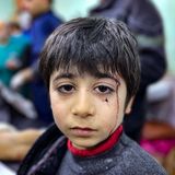 Dieses verletzte Kind wartet im Krankenhaus auf seine Behandlung