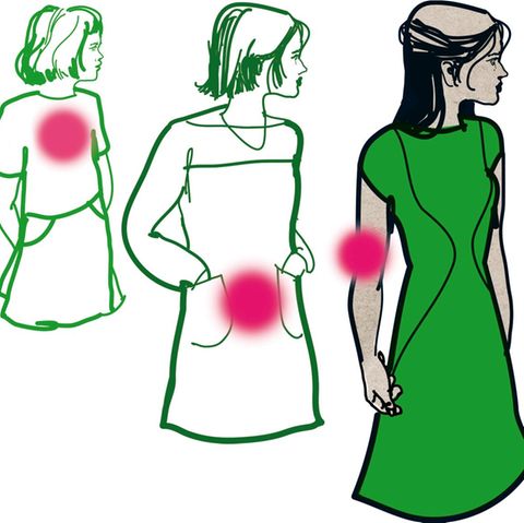 Illustration einer jungen Patientin