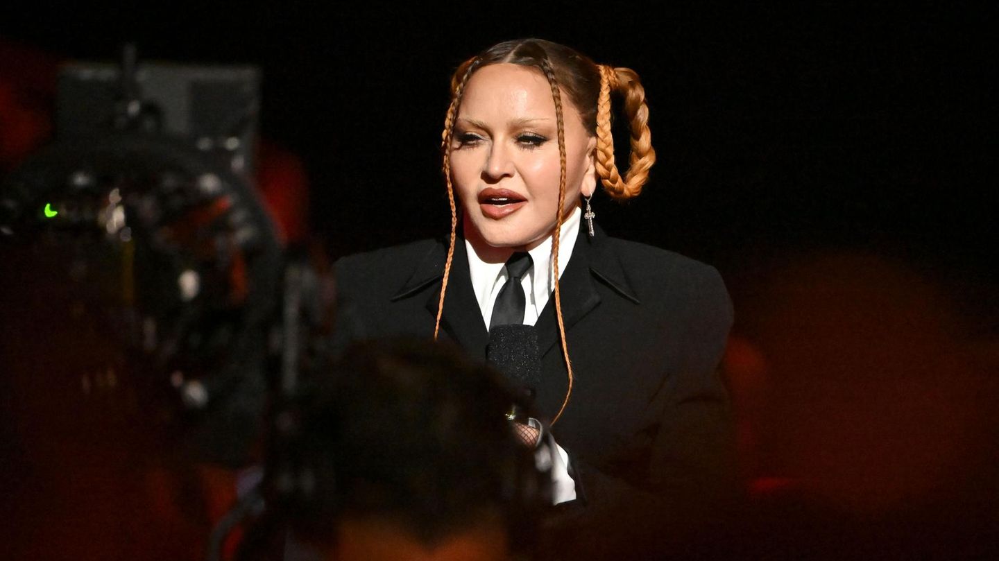 Nach Grammy-Auftritt: Eine ganze Reihe von Eingriffen – Schönheitschirurgen schätzen den Preis von Madonnas OPs