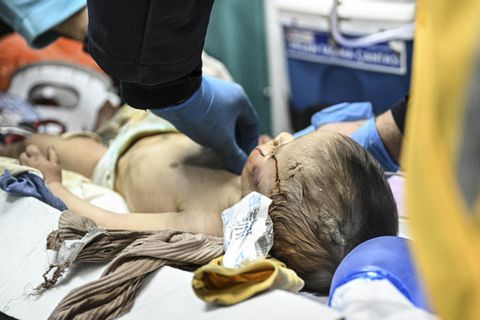 Der sieben Monate alte Hamza musste über 140 Stunden in den Trümmern ausharren