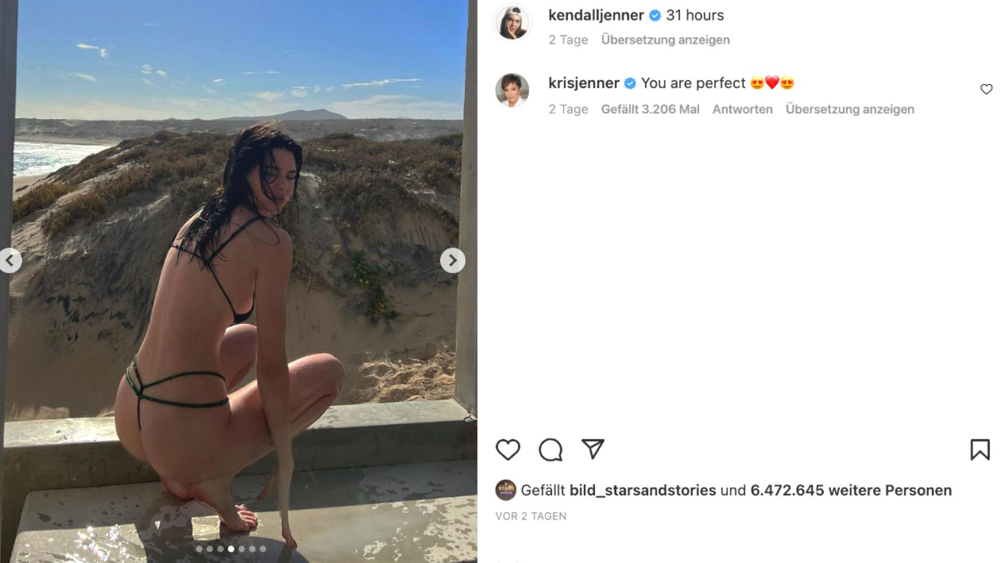 “Like a dog’s paw”: Followers discuss Kendall Jenner’s hand