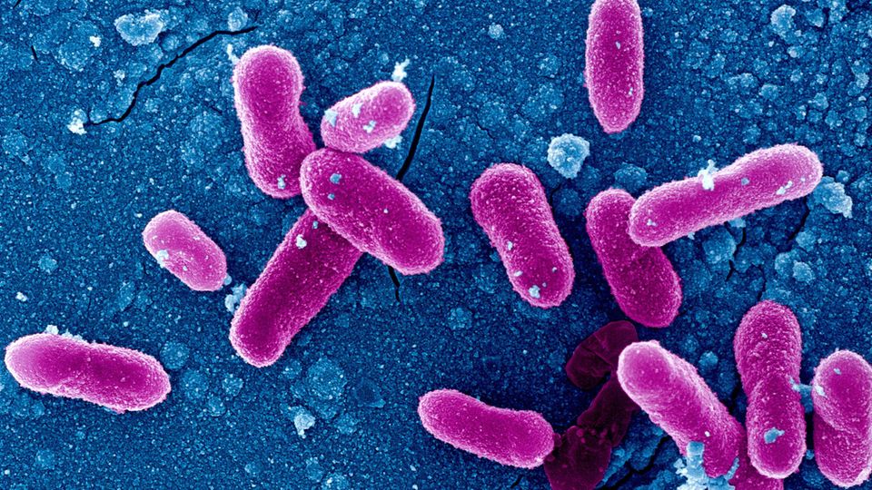 Sepsis: Staphylokokken können neben vielen weiteren Erregern eine Blutvergiftung auslösen