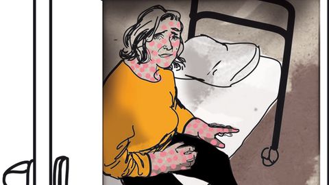 Die Diagnose: Bei der Patientin verfärbt sich die Haut, die Gelenke schmerzen und das Fieber kommt in Schüben