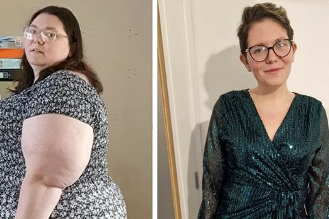 Keine Marmite-Sandwiches mehr: 32-Jährige nimmt 100 Kilogramm ab