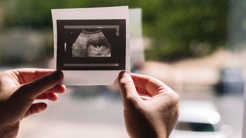 Abtreibungsverbot: Eine Frau hält ein Ultraschallbild in der Hand
