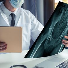Hüftchirurgie: Das sind empfehlenswerte Ärzte in Ihrer Region