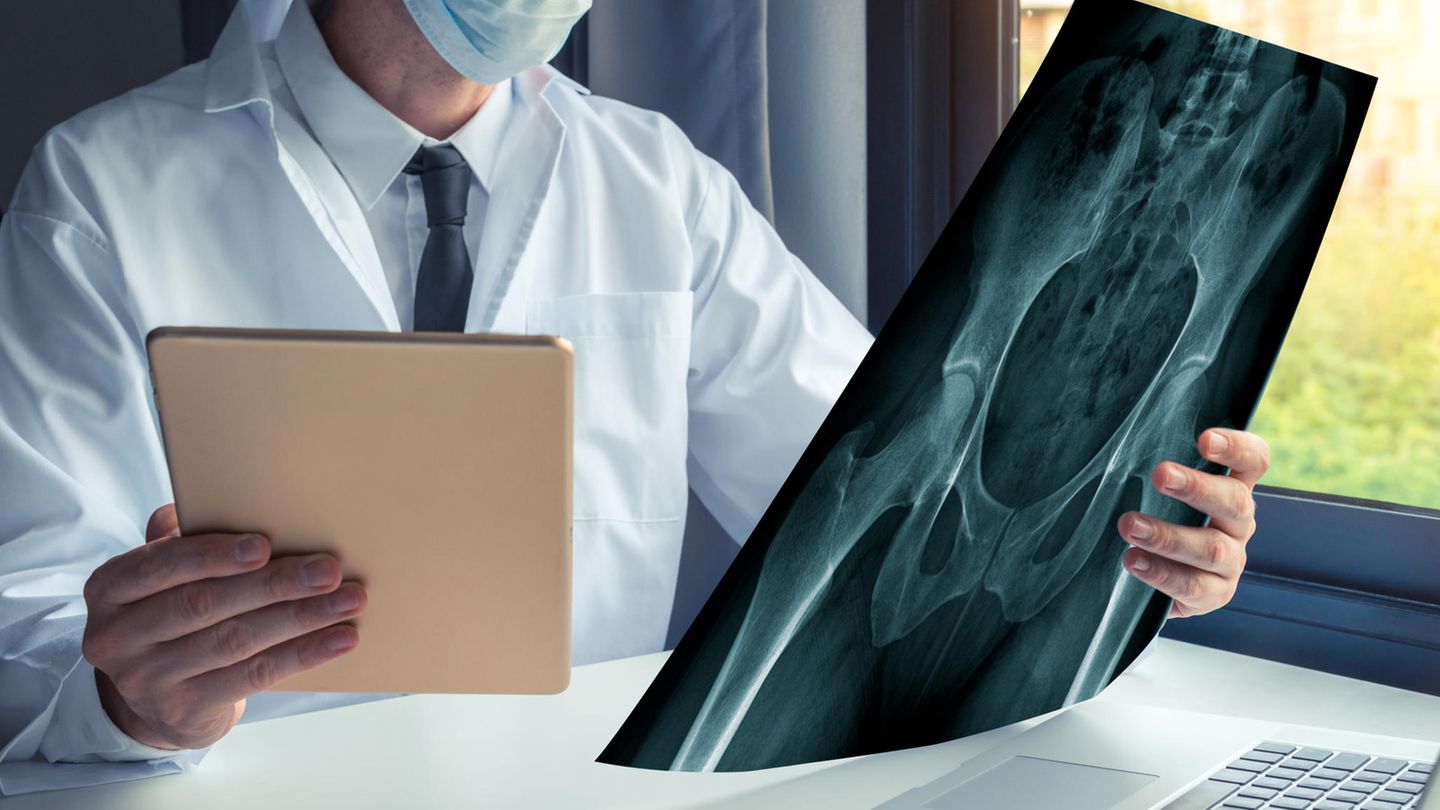 Hüftchirurgie: Das sind empfehlenswerte Ärzte in Ihrer Region