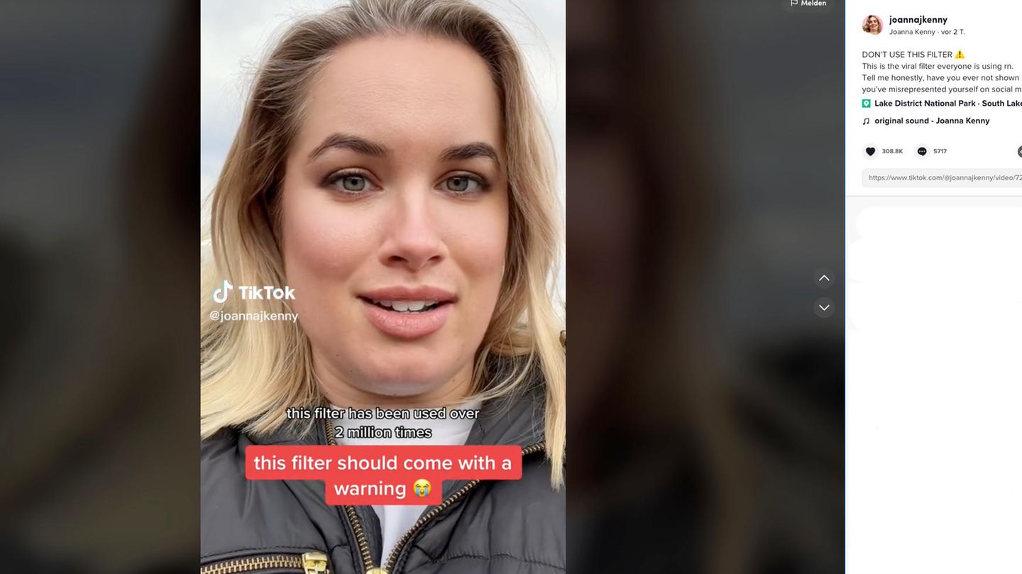 Influencerin Joanna Kenny warnt vor dem TikTok-Filter "Bold Glamour". Er macht die Haut ebenmäßig und die Lippen voll.