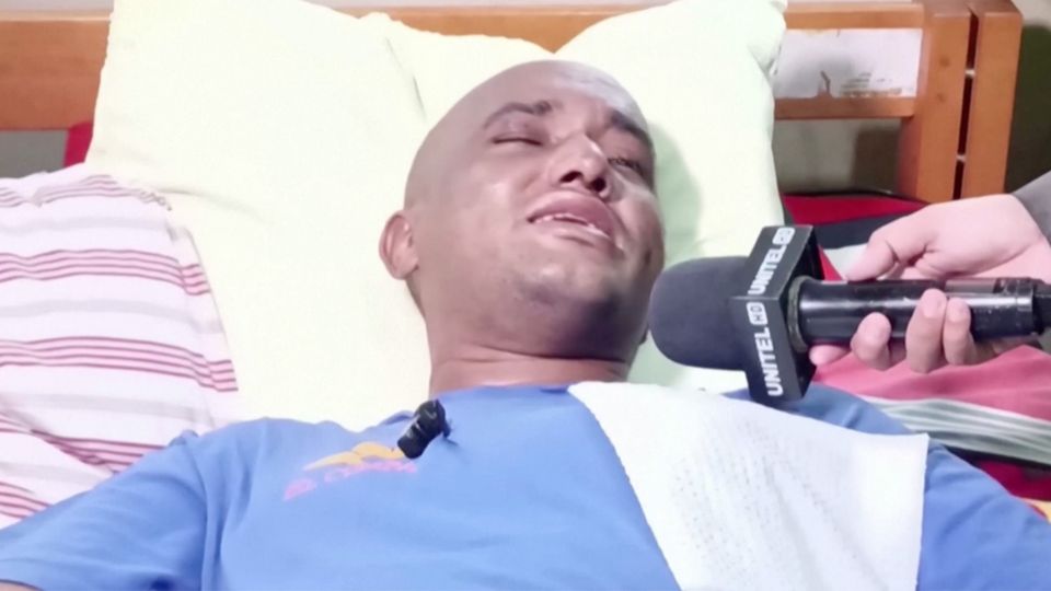 Nach Jagdausflug verschollen: Mit Glück und Würmern: Wie ein Mann einen Monat im Dschungel überlebte