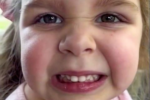 Mädchen Ruby : Vierjährige kann nicht lächeln – ein Grund zur Sorge? Kinderarzt erklärt das Phänomen